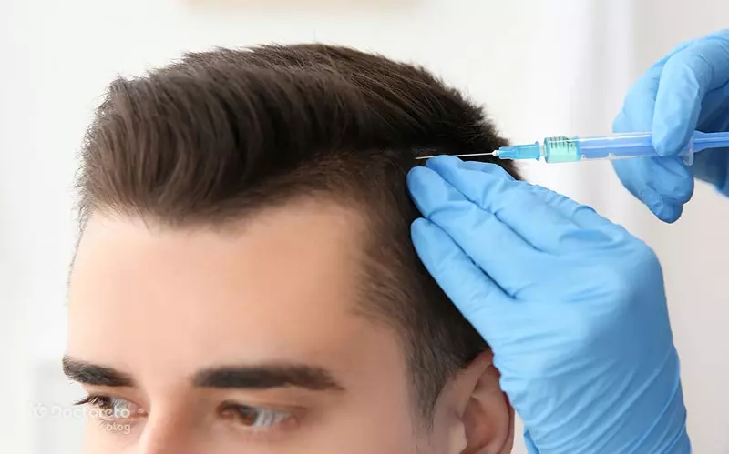 خدمات مزوتراپی مو آقایان در تهران خیابان فرشته